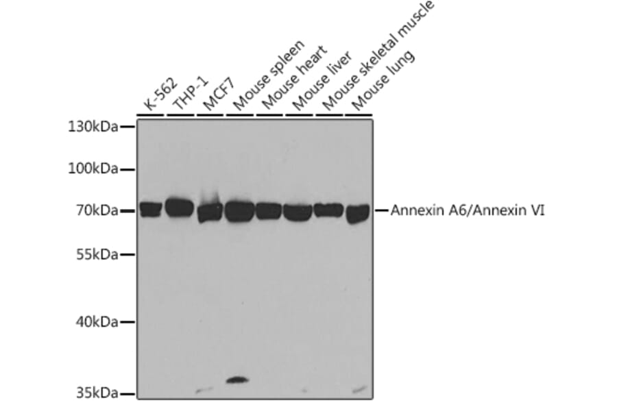 Western Blot - Anti-Annexin-6/ANXA6 Antibody (A14725) - Antibodies.com