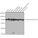 Western Blot - Anti-Annexin-6/ANXA6 Antibody (A14725) - Antibodies.com