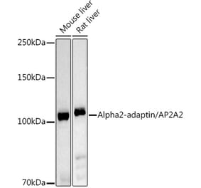 Western Blot - Anti-alpha Adaptin Antibody (A14726) - Antibodies.com