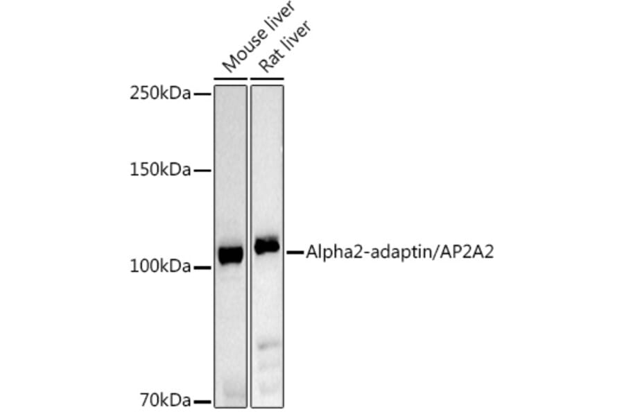 Western Blot - Anti-alpha Adaptin Antibody (A14726) - Antibodies.com