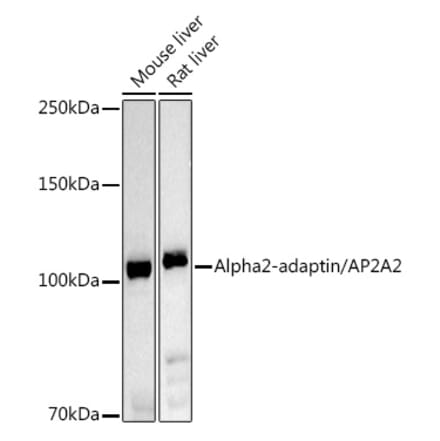 Western Blot - Anti-alpha Adaptin Antibody (A14726) - Antibodies.com