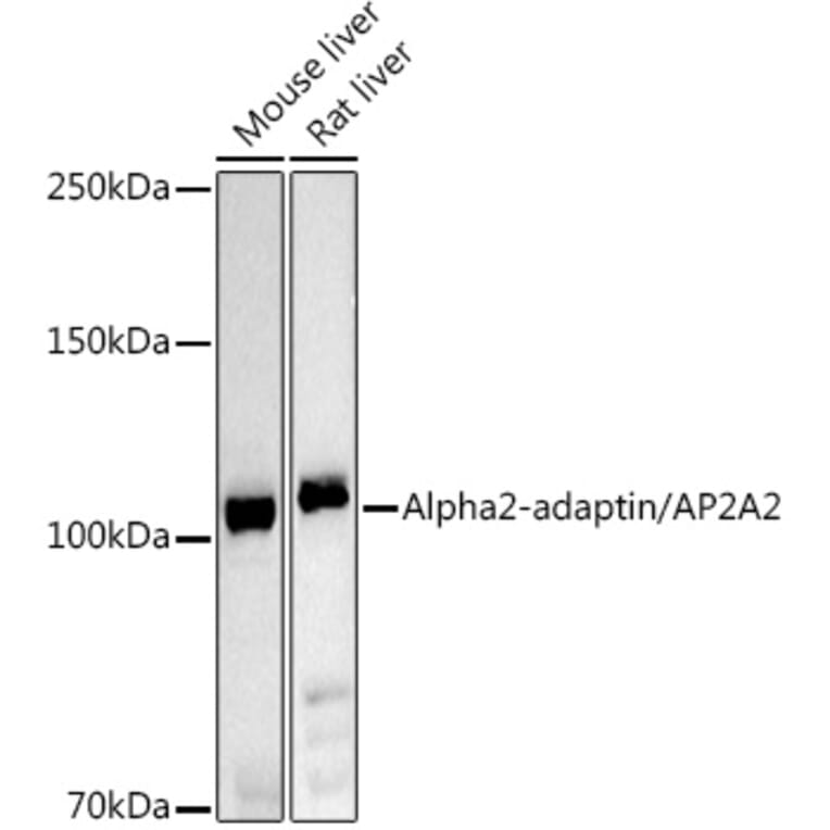 Western Blot - Anti-alpha Adaptin Antibody (A14726) - Antibodies.com