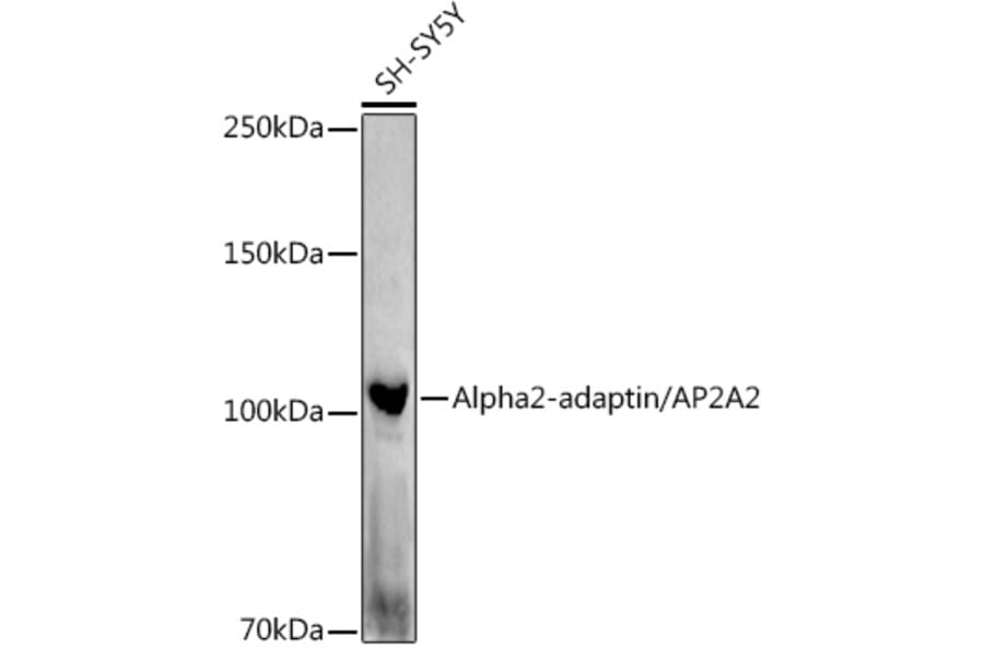Western Blot - Anti-alpha Adaptin Antibody (A14726) - Antibodies.com