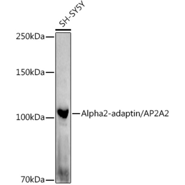 Western Blot - Anti-alpha Adaptin Antibody (A14726) - Antibodies.com