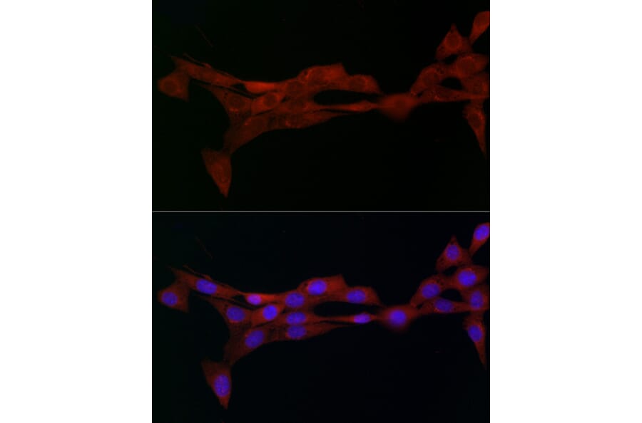 Immunofluorescence - Anti-alpha Adaptin Antibody (A14726) - Antibodies.com