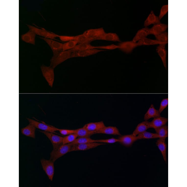 Immunofluorescence - Anti-alpha Adaptin Antibody (A14726) - Antibodies.com
