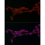 Immunofluorescence - Anti-alpha Adaptin Antibody (A14726) - Antibodies.com