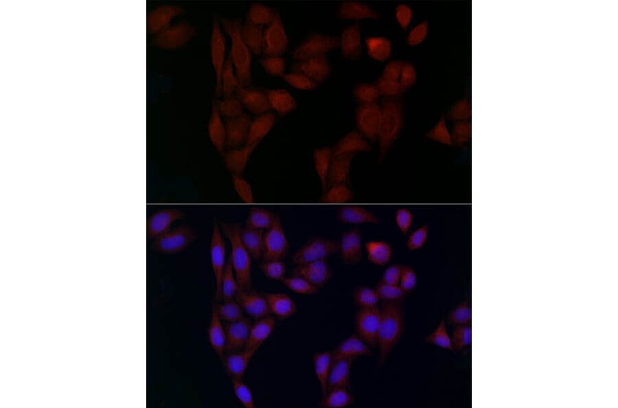 Immunofluorescence - Anti-alpha Adaptin Antibody (A14726) - Antibodies.com