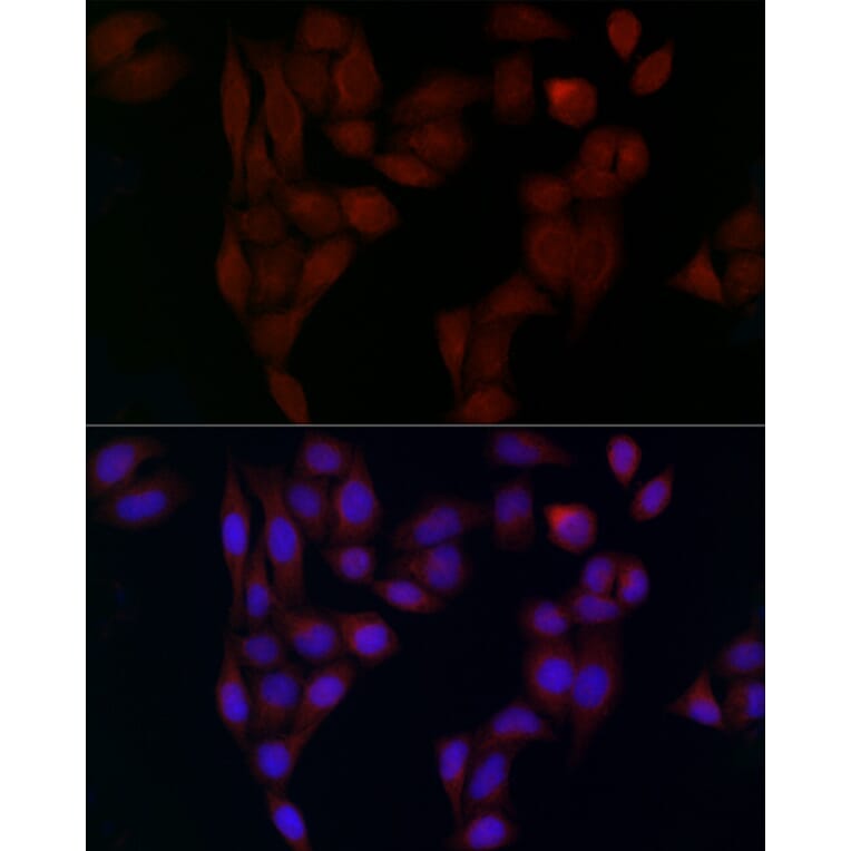 Immunofluorescence - Anti-alpha Adaptin Antibody (A14726) - Antibodies.com
