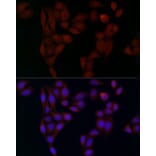 Immunofluorescence - Anti-alpha Adaptin Antibody (A14726) - Antibodies.com