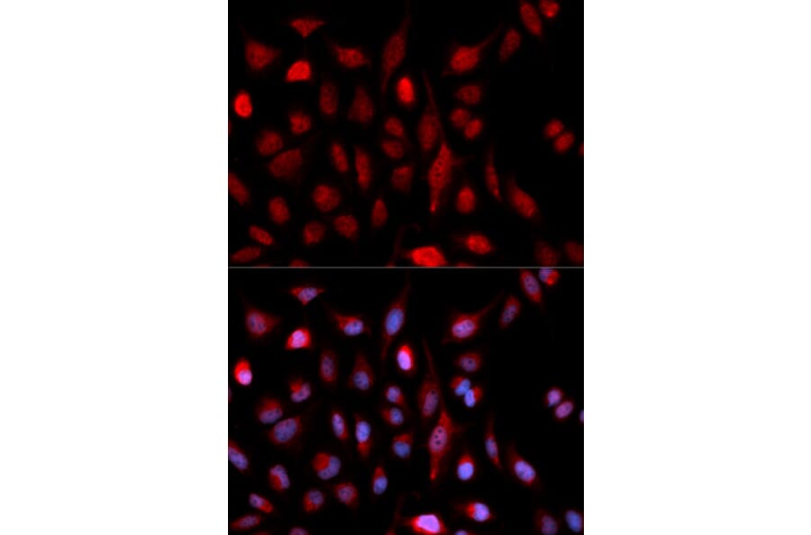 Immunofluorescence - Anti-ASH2L Antibody (A5392) - Antibodies.com