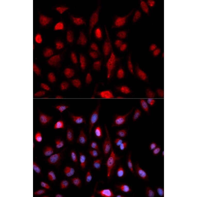 Immunofluorescence - Anti-ASH2L Antibody (A5392) - Antibodies.com