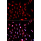 Immunofluorescence - Anti-ASH2L Antibody (A5392) - Antibodies.com