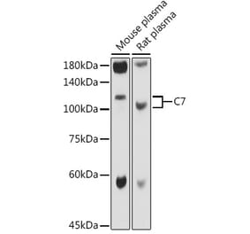 Western Blot - Anti-C7 Antibody (A14729) - Antibodies.com
