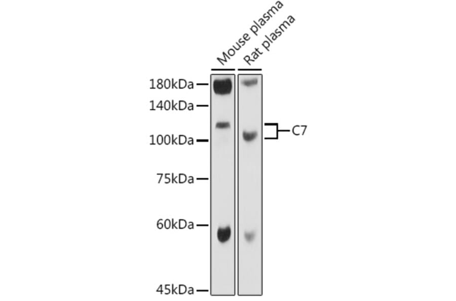 Western Blot - Anti-C7 Antibody (A14729) - Antibodies.com