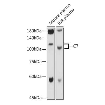 Western Blot - Anti-C7 Antibody (A14729) - Antibodies.com