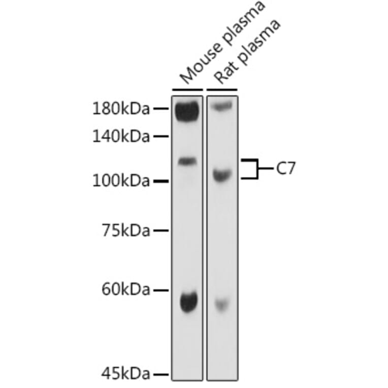 Western Blot - Anti-C7 Antibody (A14729) - Antibodies.com