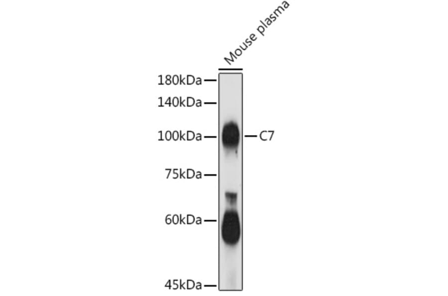 Western Blot - Anti-C7 Antibody (A14729) - Antibodies.com