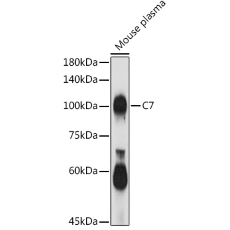 Western Blot - Anti-C7 Antibody (A14729) - Antibodies.com