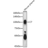 Western Blot - Anti-C7 Antibody (A14729) - Antibodies.com