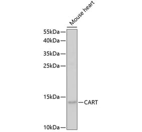Western Blot - Anti-CART Antibody (A14730) - Antibodies.com