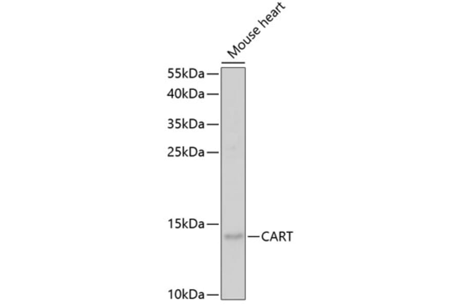 Western Blot - Anti-CART Antibody (A14730) - Antibodies.com