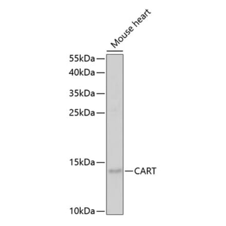 Western Blot - Anti-CART Antibody (A14730) - Antibodies.com