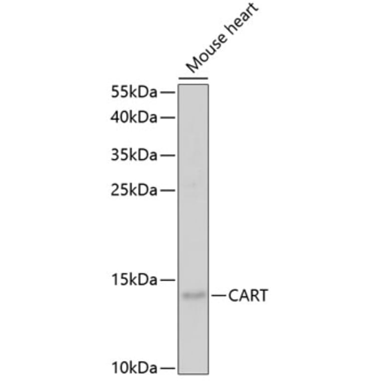 Western Blot - Anti-CART Antibody (A14730) - Antibodies.com