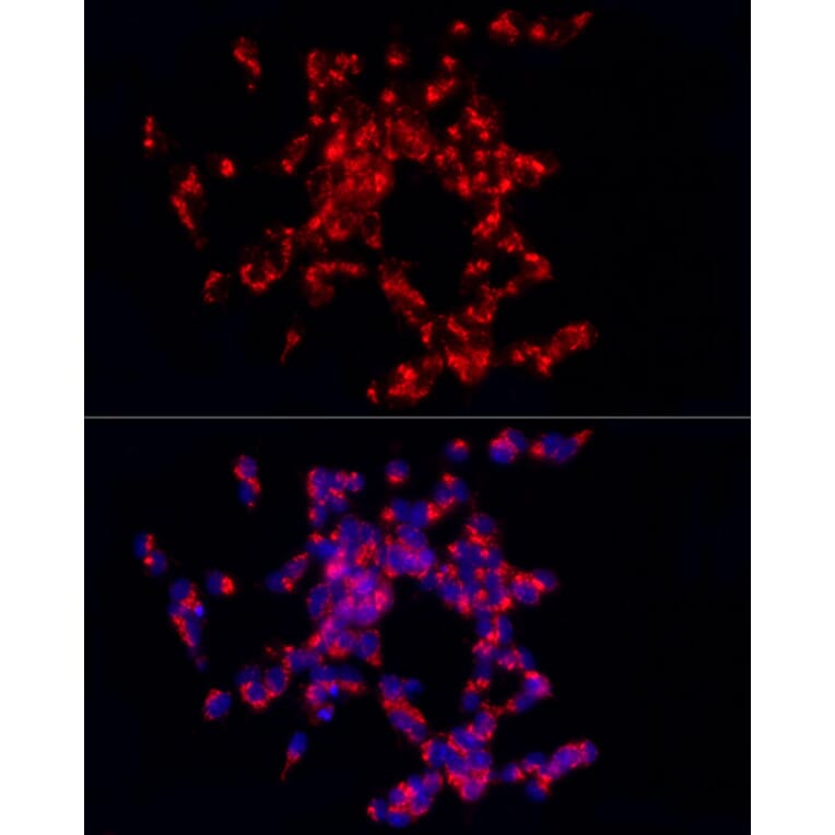 Immunofluorescence - Anti-CART Antibody (A14730) - Antibodies.com