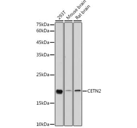 Western Blot - Anti-Centrin 2 Antibody (A14731) - Antibodies.com