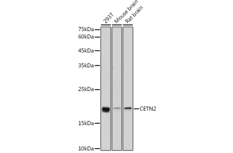 Western Blot - Anti-Centrin 2 Antibody (A14731) - Antibodies.com