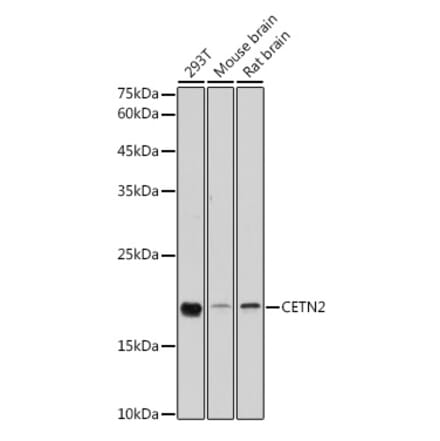 Western Blot - Anti-Centrin 2 Antibody (A14731) - Antibodies.com