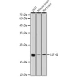 Western Blot - Anti-Centrin 2 Antibody (A14731) - Antibodies.com