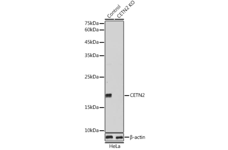 Western Blot - Anti-Centrin 2 Antibody (A14731) - Antibodies.com