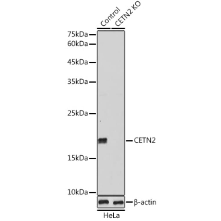 Western Blot - Anti-Centrin 2 Antibody (A14731) - Antibodies.com