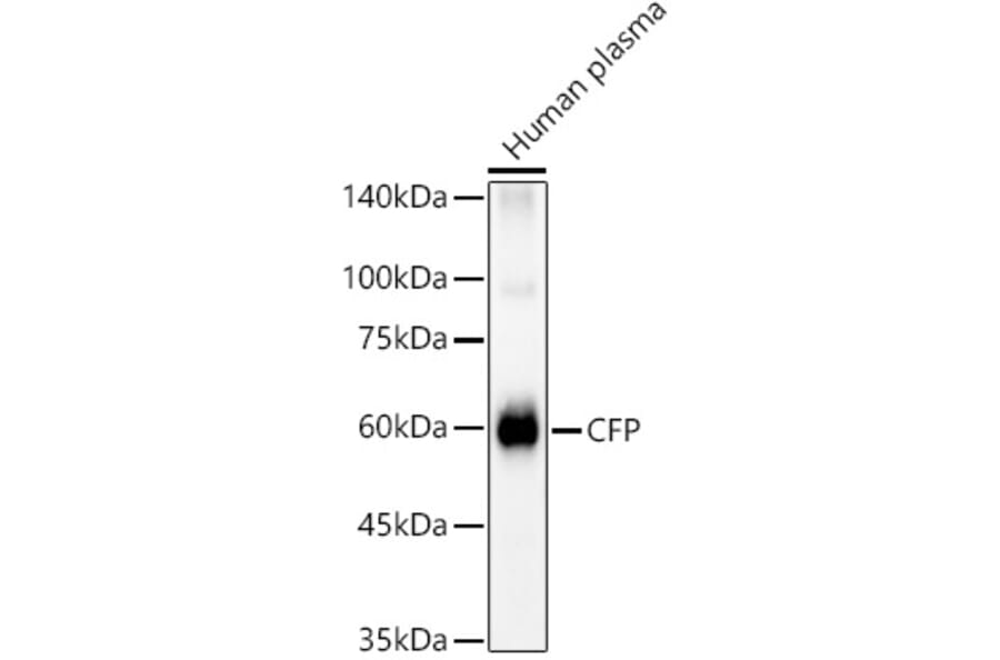 Western Blot - Anti-Properdin/PFC Antibody (A14732) - Antibodies.com