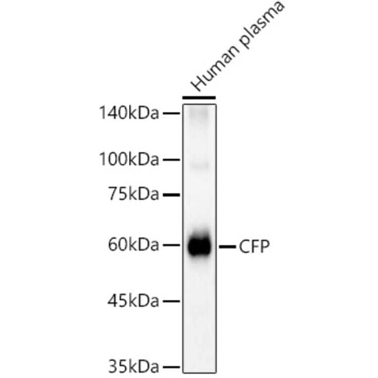 Western Blot - Anti-Properdin/PFC Antibody (A14732) - Antibodies.com