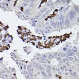 Immunohistochemistry - Anti-Properdin/PFC Antibody (A14732) - Antibodies.com