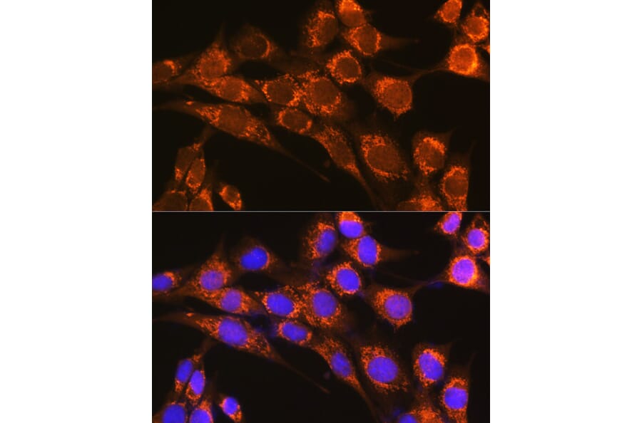 Immunofluorescence - Anti-Properdin/PFC Antibody (A14732) - Antibodies.com