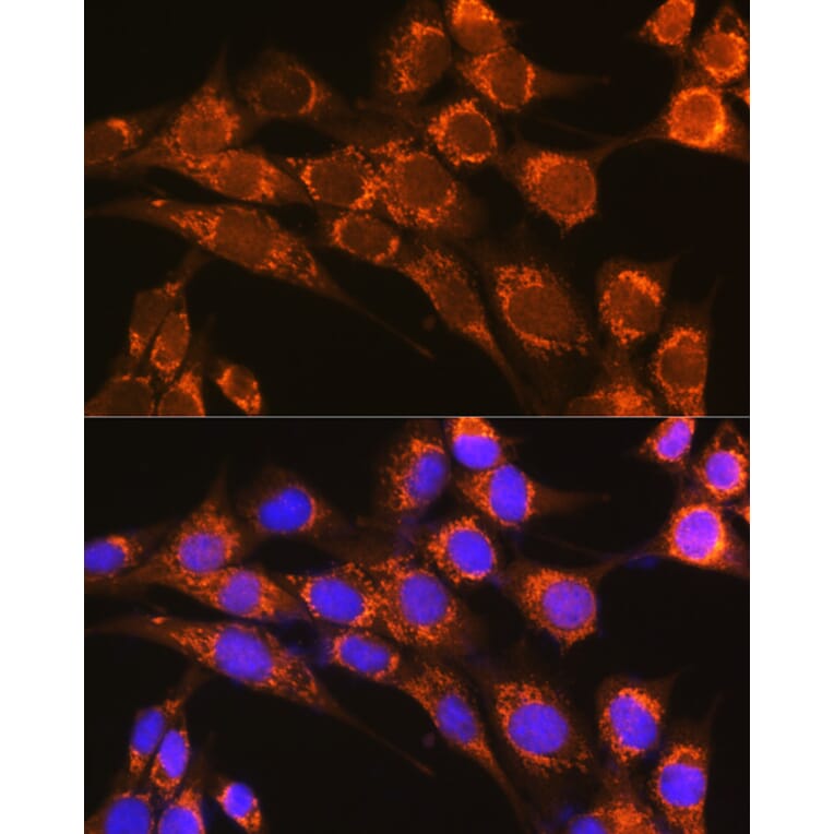 Immunofluorescence - Anti-Properdin/PFC Antibody (A14732) - Antibodies.com