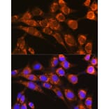 Immunofluorescence - Anti-Properdin/PFC Antibody (A14732) - Antibodies.com