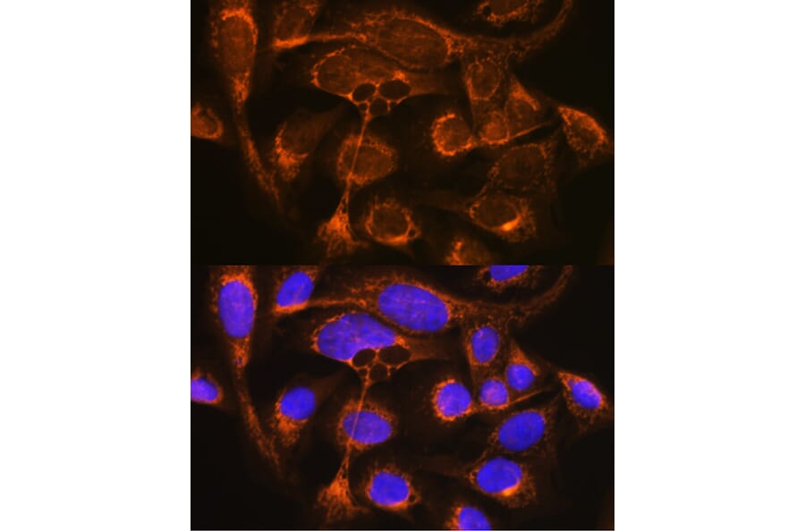 Immunofluorescence - Anti-Properdin/PFC Antibody (A14732) - Antibodies.com