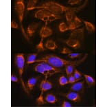 Immunofluorescence - Anti-Properdin/PFC Antibody (A14732) - Antibodies.com