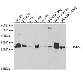 Western Blot - Anti-CHMP2B Antibody (A14733) - Antibodies.com