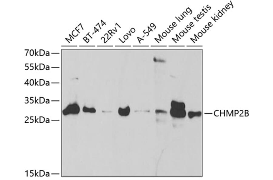 Western Blot - Anti-CHMP2B Antibody (A14733) - Antibodies.com