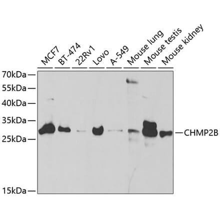 Western Blot - Anti-CHMP2B Antibody (A14733) - Antibodies.com