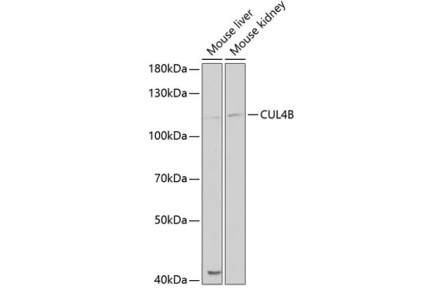 Western Blot - Anti-Cullin 4B / CUL-4B Antibody (A14734) - Antibodies.com