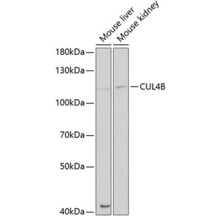 Western Blot - Anti-Cullin 4B / CUL-4B Antibody (A14734) - Antibodies.com