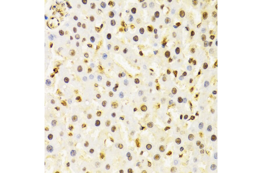Immunohistochemistry - Anti-Cullin 4B / CUL-4B Antibody (A14734) - Antibodies.com
