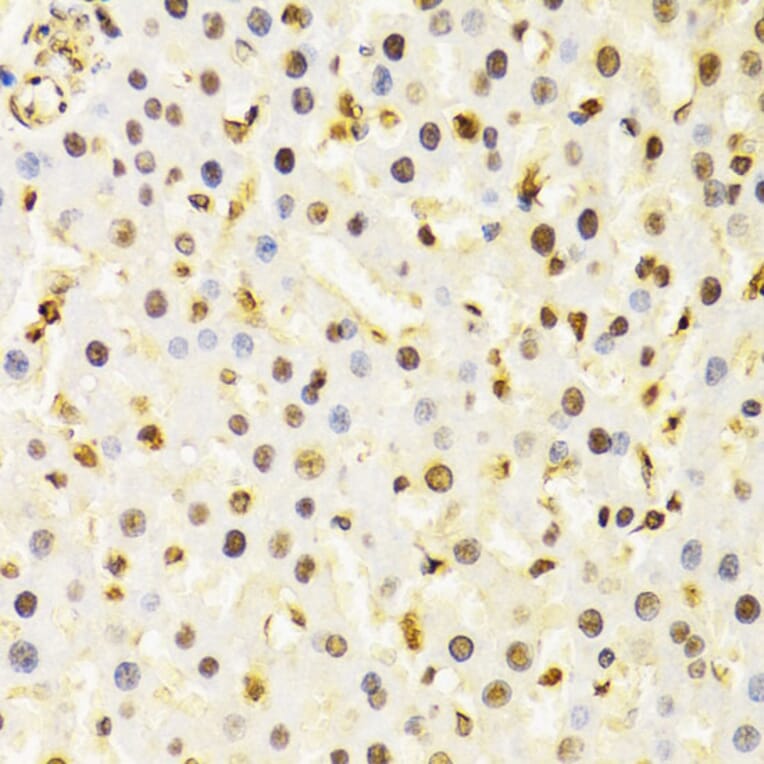 Immunohistochemistry - Anti-Cullin 4B / CUL-4B Antibody (A14734) - Antibodies.com
